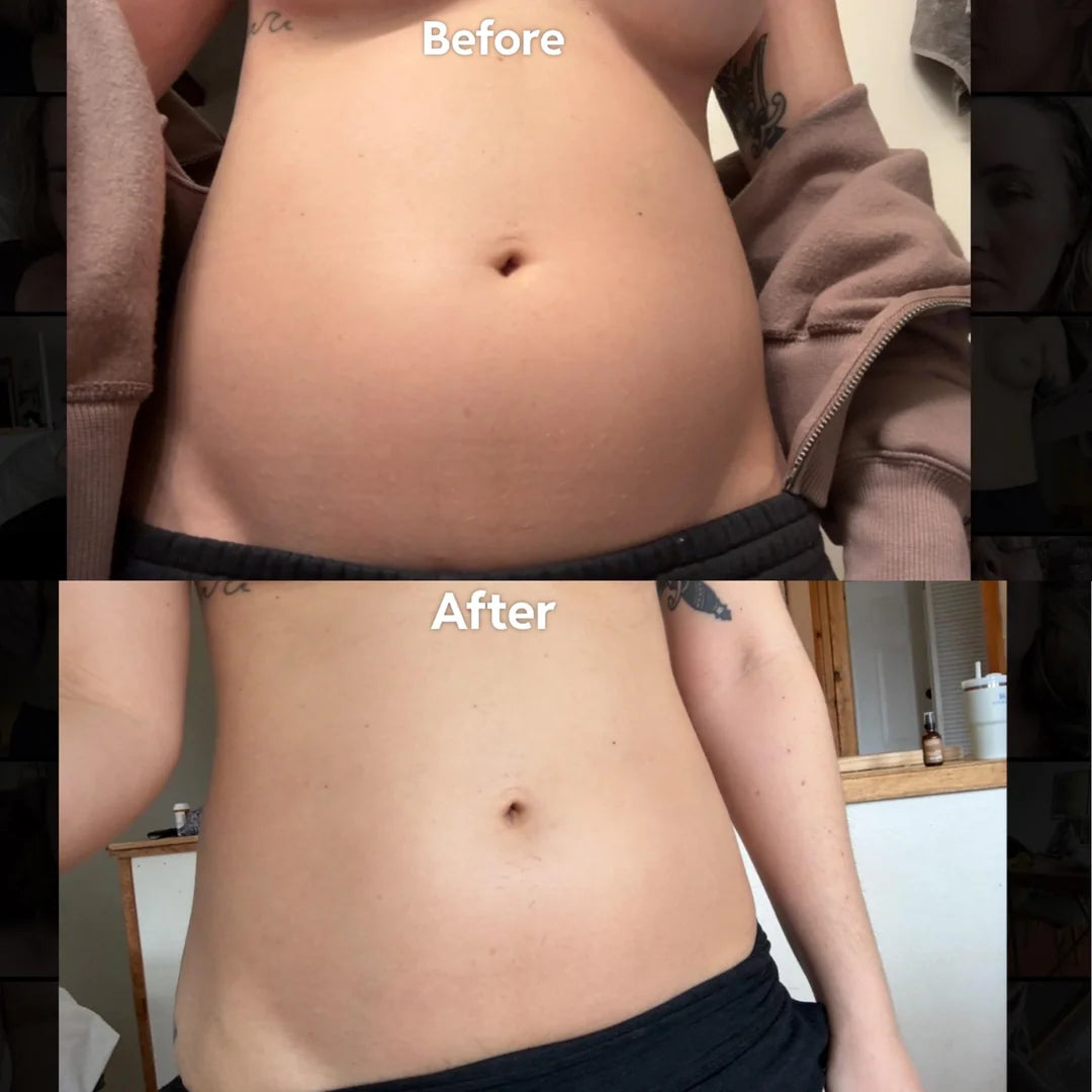 Alolevi SnatchPatch™