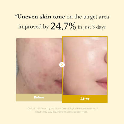 Kojic Acid Turmeric Overnight Mask™