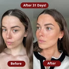 Astaxanthin Softgels By Alolevi™